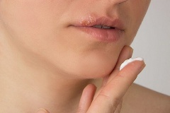 Простуда на губах – причины, симптомы, лечение и профилактика